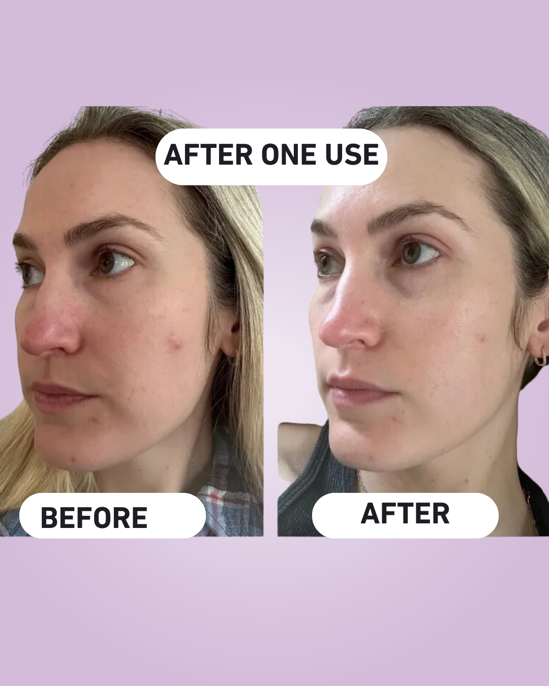 GlowSignal™ Peelshot - Powered by Radiance Recode