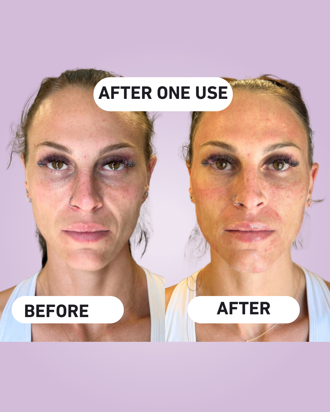 GlowSignal™ Peelshot - Powered by Radiance Recode